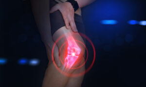 La importancia del ligamento principal en la rodilla